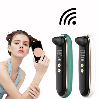 China Blackhead Remover Black Head Obvious Camera Portable Vacuum Blackhead Removal Tool Kit for sale