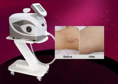 China Powerful Laser Treatment Diode Laser Hair Removal Machine With Sapphire Crystal for sale