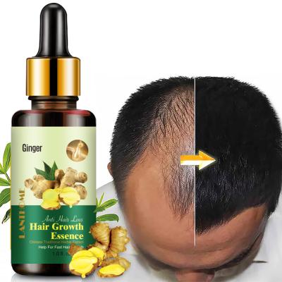 China Wholesale 100% Natural Herbal 30ml Ginger Oil 7 Day Hair Growth Essential Oil For Hair Loss Treatment Regrowth Serum for sale