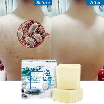 China Whitening Natural Organic Private Label Sea Salt Soap Whitening Handmade Goat Milk Soap For Remove Skin Acne Face Deep Cleansing Care for sale