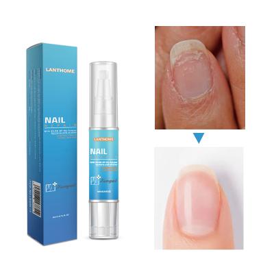 China Easy Apply Lanhome Private Label Fiber Oil Fungal Liquid Serum Organic Essence Cracked Finger Toe Nail Repair Pen for sale