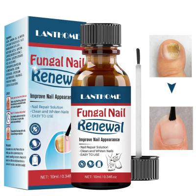 China Finger Nail Beauty Private Label Factory Price Anti Fungal Liquid Nail Treatment Home Use Nail Repair Renewal for sale