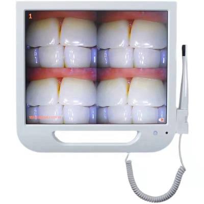 China New Product Dental Scanner Price Intra Unit Plastic Dental Oral Camera for sale