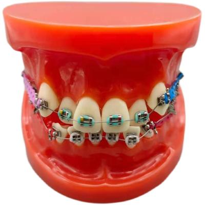 China Orthodontic Department Dental Models Teaching Braces Orthodontic Training Teeth Models With Bracket Power Ligature Link Arch Chain Wire for sale