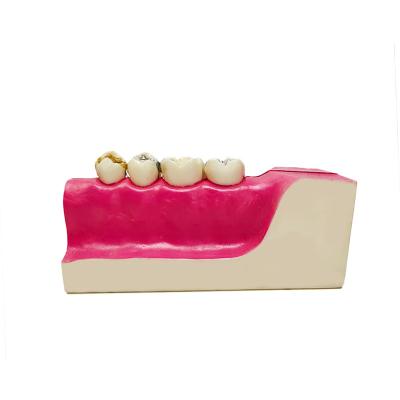 China Resin Lower Jaw Anatomy Appearance Nervous Tissue Oral Structure Model for sale