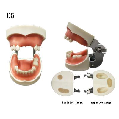 China Patient Care Demonstration Dental Implant Practice Oral Implant Operation Training Model for sale