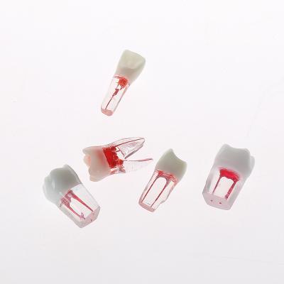 China Restoration Oral Dental Exercises Root Canal Training Models Tooth Model for sale