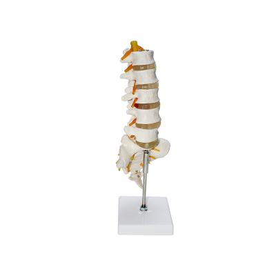 China Patients Care Demonstration 1:1 Life Size Lumbar Vertebrae Spine Set Anatomy Model for sale