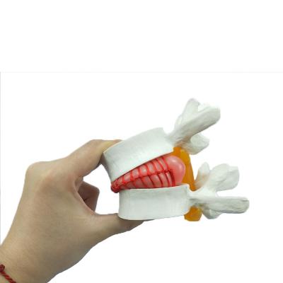 China Patients Care Anatomical Human Demonstration Lumbar Spine Model for sale