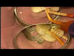 SANI TREATMENT CASE