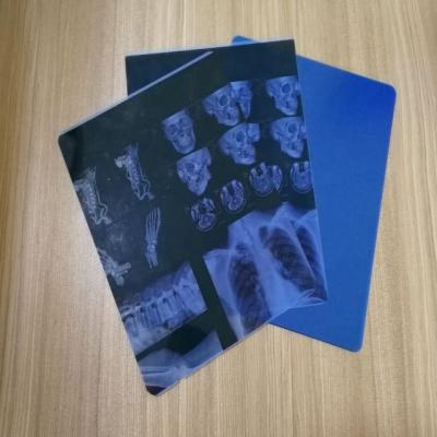 China Printing Waterproof Anti-hot Medical X-Ray Film for sale