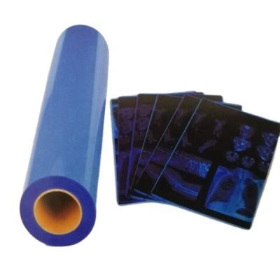 China Moisture Proof Waterproof Blue Pet Inkjet Laser X Ray Medical Film For Epson CT CR MR for sale