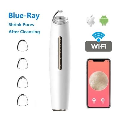 China WIFI HD Blackhead Obvious Blackhead Remover Vacuum Acne Blackhead Treatment Visual Suction Removal With Camera for sale