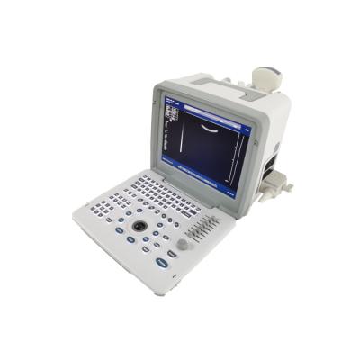 中国 Metal See Laptop B W Portable Pregnancy Doppler Probe Scanner Radio Fetal Ultrasound Machine For Baby 販売のため