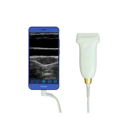 Κίνα GYN ultrasound probe convex wifi usb wireless ultrasound probes for android προς πώληση