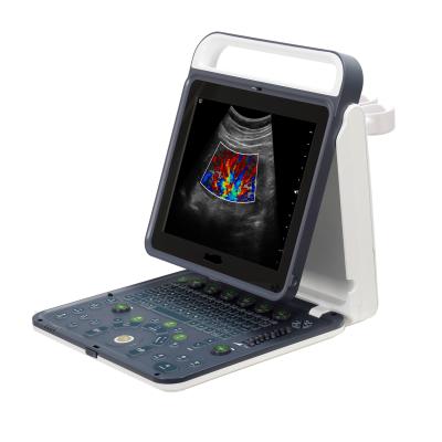 Cina Hospital Outside 2020 New Portable Digital 15 Inch Color Doppler Ultrasound Machine in vendita