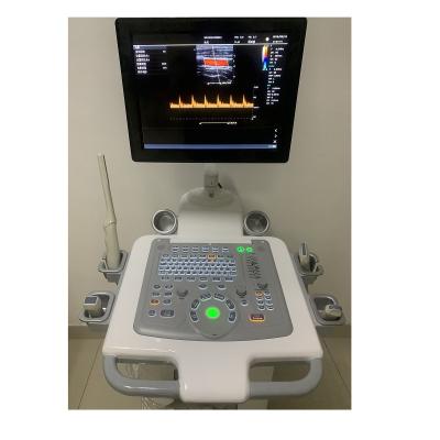 China Hospital Outside Trolley 15Inch Ultrasound Machine Ultrasound Digital Color Doppler Ultrasound Machines edical for sale