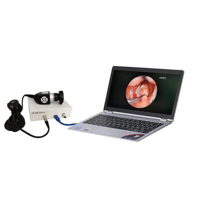 China All portable endoscopy hd endoscopic camera surgical system set medical equipment with USB for gynecology hysteroscopy resectoscope for sale