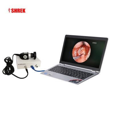 China All Usb Endoscopic Surgical Medical HD Endoscopic Camera For Scope Ear Nose Portable Nasal Camera With USB Interface for sale