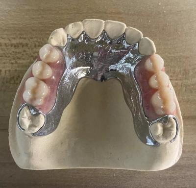 China Hoogsterkte giet metaal gedeeltelijke tandheelkunde Cocr Aolly Met 3D-printen Te koop