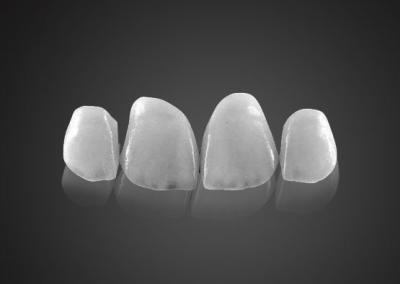 China IPS 0.2mm Ultra fina Emax Veneers resistente a manchas com alta resistência à venda