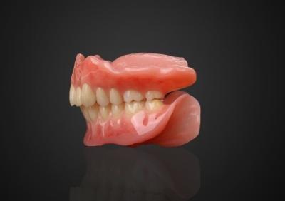 China Immediate Adsorptive Acrylic Base Partial Denture Removable And Comfortable for sale