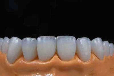 China Highly Translucent Esthetic Zirconia Crowns Precise Fit with Natural Looking for sale