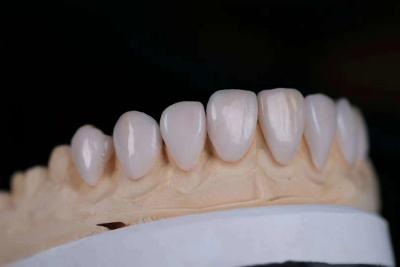 China Coronas de laboratório dentário de alta estética porcelana revestida de zircônio resistência à mancha à venda