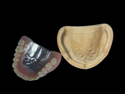 Cina Riparazione parziale della protesi metallica rimovibile con denti acrilici Yamahachi in vendita