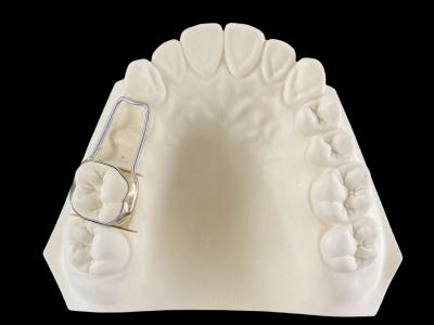 China Flexible band and loop space maintainer verstelbaar orthodontisch functionele apparaat Te koop