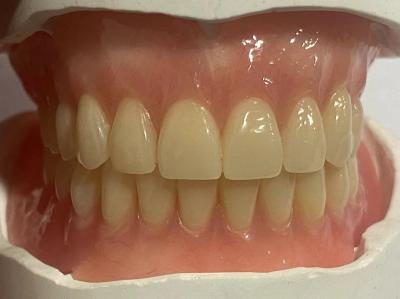 China Hypoallergenic Customized Removable Partial Denture With Pink Gum Color for sale