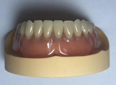 China Dental Lab Acrylic Full Arch Dentures Easy To Use With Natural Shape for sale