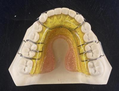 China Retentor Ortodôntico Hawley Portátil Durável com Superfície Suave à venda