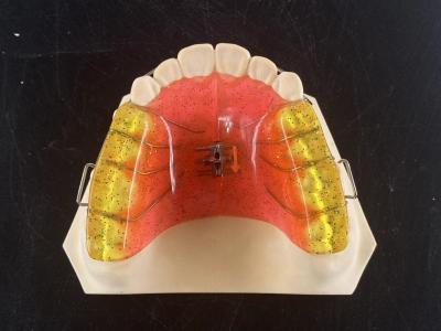 China Aplicativo de ortodontia ajustável de expansão de arco dental de 2 vias personalizado à venda