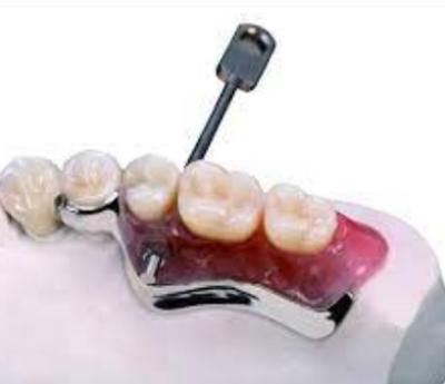 China Fácil de instalar llave y llavero de la cerradura de la conexión dental resistente a la oxidación en venta