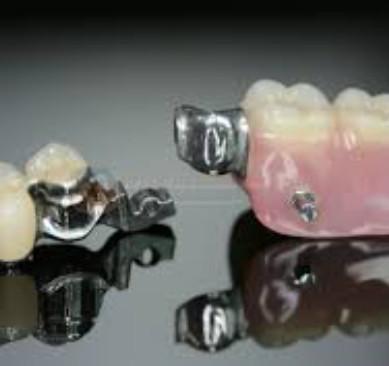 China Alta flexibilidad Mk1 Apego Dental Alta precisión y seguridad de uso en venta