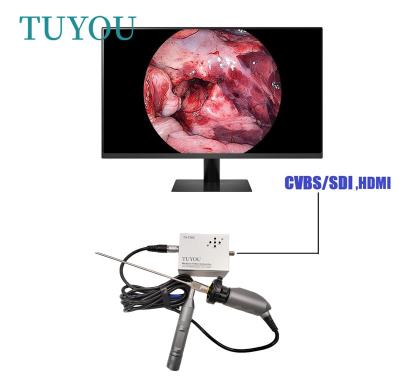 China Full HD Electric Portable ENT Endoscope Medical Camera For Laptop Computer for sale