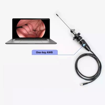 China Electric Full HD CMOS Medical Portable USB Endoscope Camera For ENT Nasal Otoscope Ear Laparoscopic Gynecology for sale