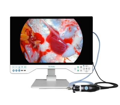 China All In One ENT Camera System With Portable HD Endoscope Camera And Light Source for sale