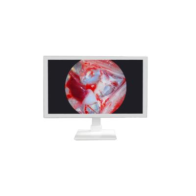 China FHD medische apparatuur 22 24 27 inch Endoscoopcamera Monitor Display Full HD medisch monitor Te koop