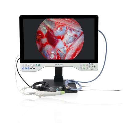 China All In One Flexible And Rigid Dual System 24 Inch FHD Endoscope Camera System for sale