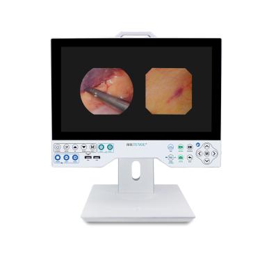 China TUYOU Full HD 1080P 15.6 Inch All In One Medical Endoscopy Camera System For ENT Sinus Urology for sale