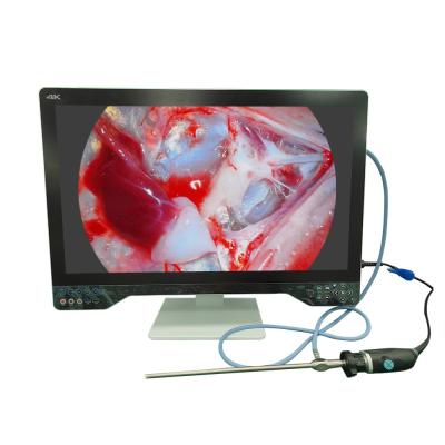 China Ultra High Definition Endoscope Camera 4K For Laparoscopy With 32