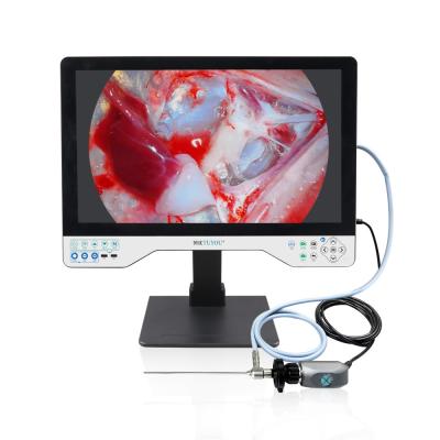 China 24in HD Endoscopie LED Lichtbron Endoscopie Camera Recorder Voor Laparoscopie Cystoscopie Operaties Te koop