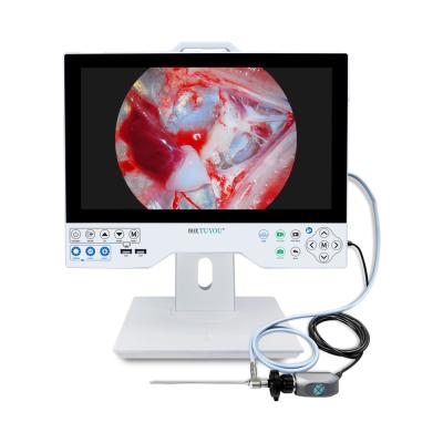 China All In One HD Endoscopie Videocamera 15,6 inch Monitor Voor ENT Laparoscopie Hysteroscopie Urologie Te koop