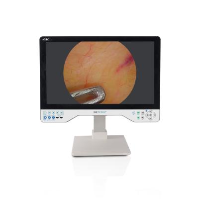 China 24 Inch Laparoscopic Monitor 4K UHD Endoscope Camera System Surgical LED With Light Source for sale