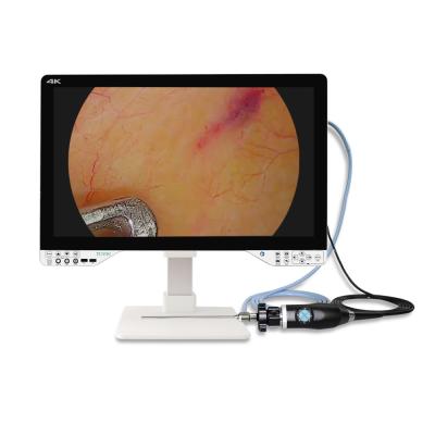 China 27 Inches Endoscope 4K For Laparoscopic Surgery With Light Source And Monitor for sale