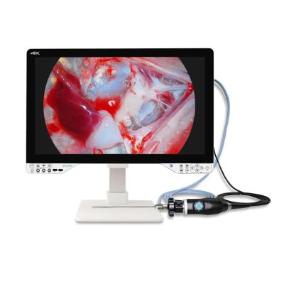 China AC110V-250V Medical 4K ENT Endoscopy Camera With Light Source And Monitor for sale