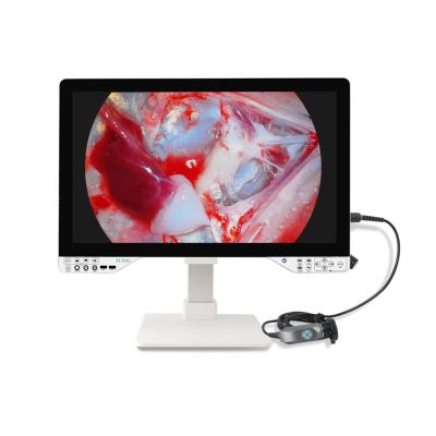 China Innovative Full HD Surgical Endoscope Camera Kit With Light Source And 27'' Monitor For Gynecology for sale