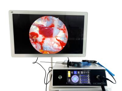 China Full HD 1080P ENT Portable Endoscopy Camera With Touchscreen And LED Light Source for sale